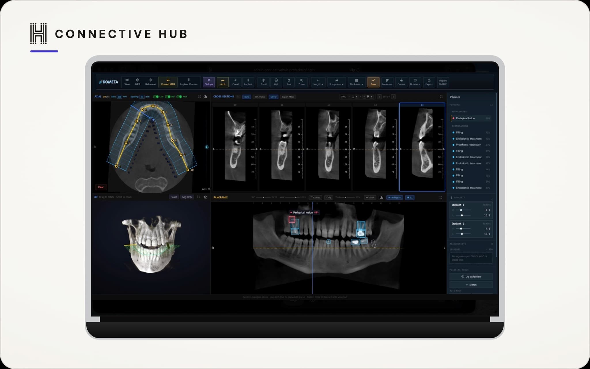 Building a DICOM Viewer That Runs in the Browser