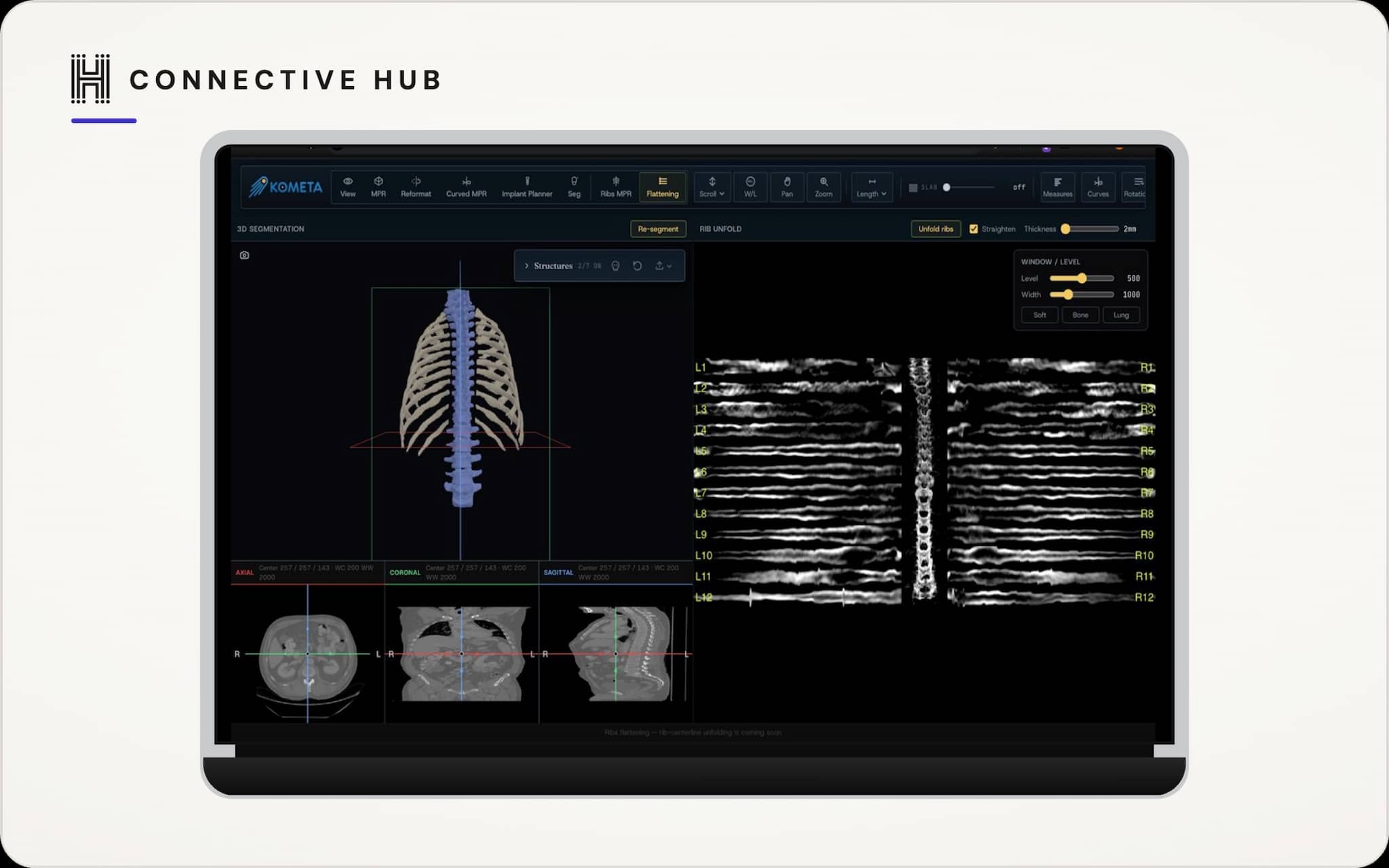 MRI / CT Vascular Imaging