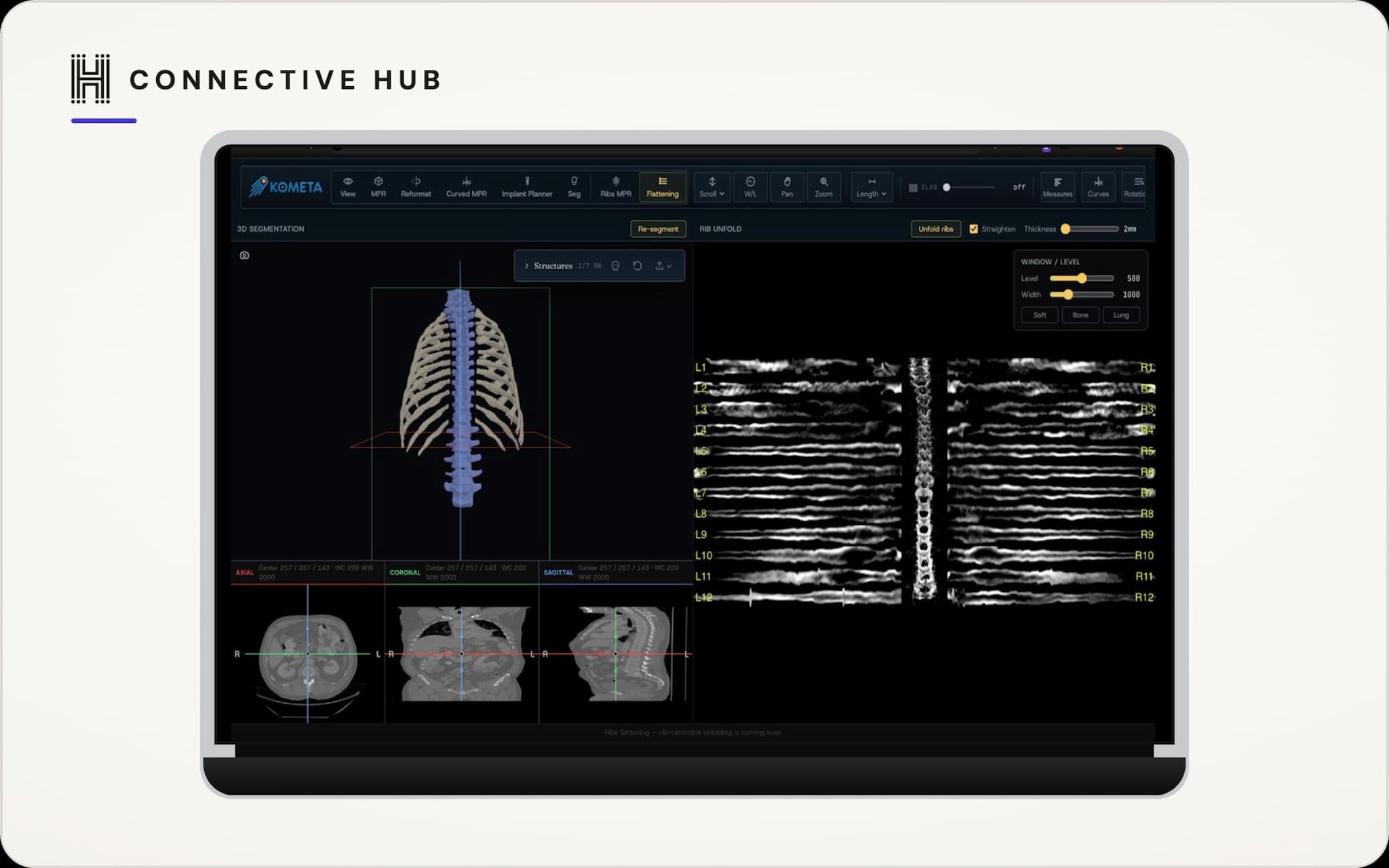 MRI / CT Vascular Imaging