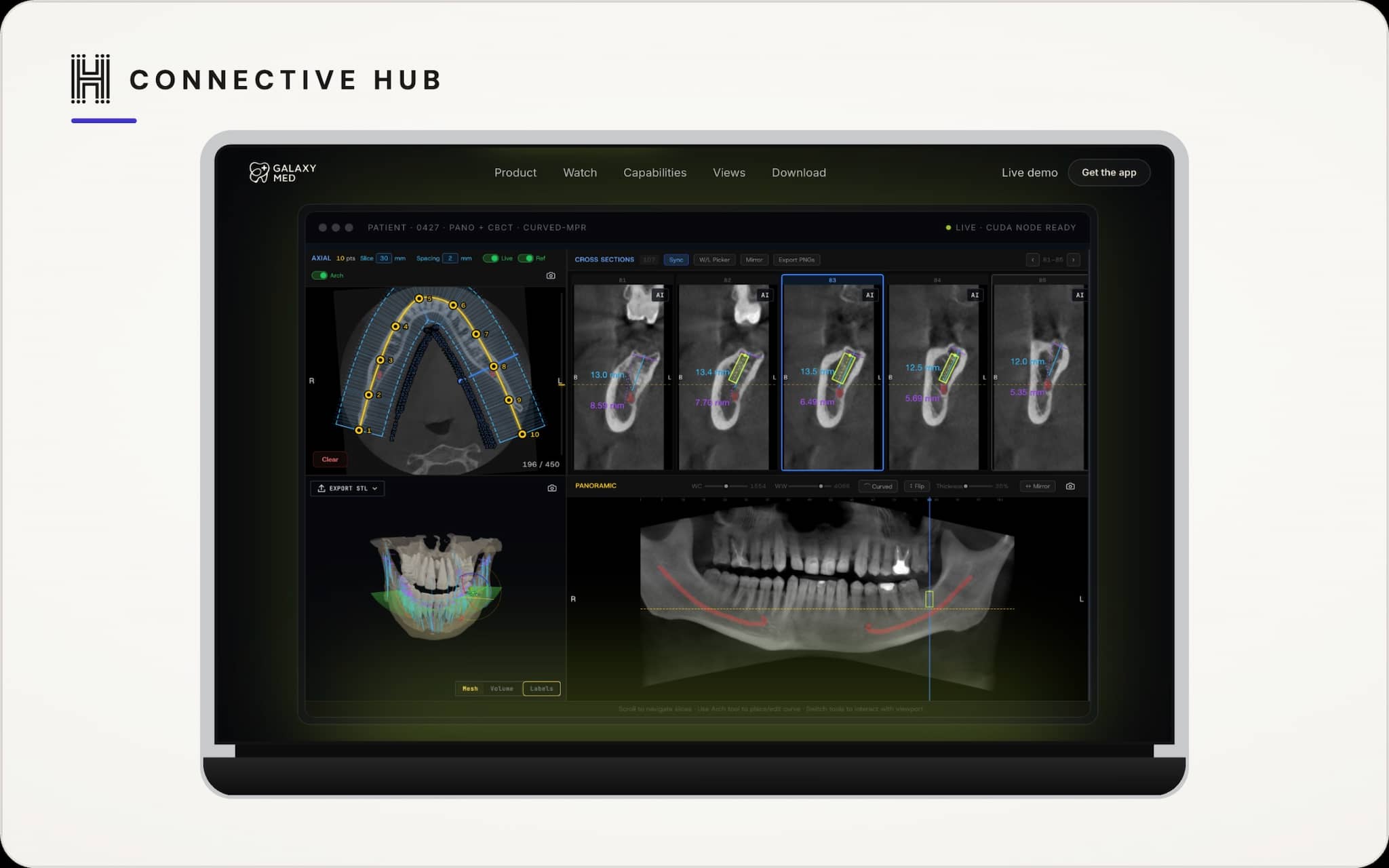 GalaxyMed — Dental Viewer