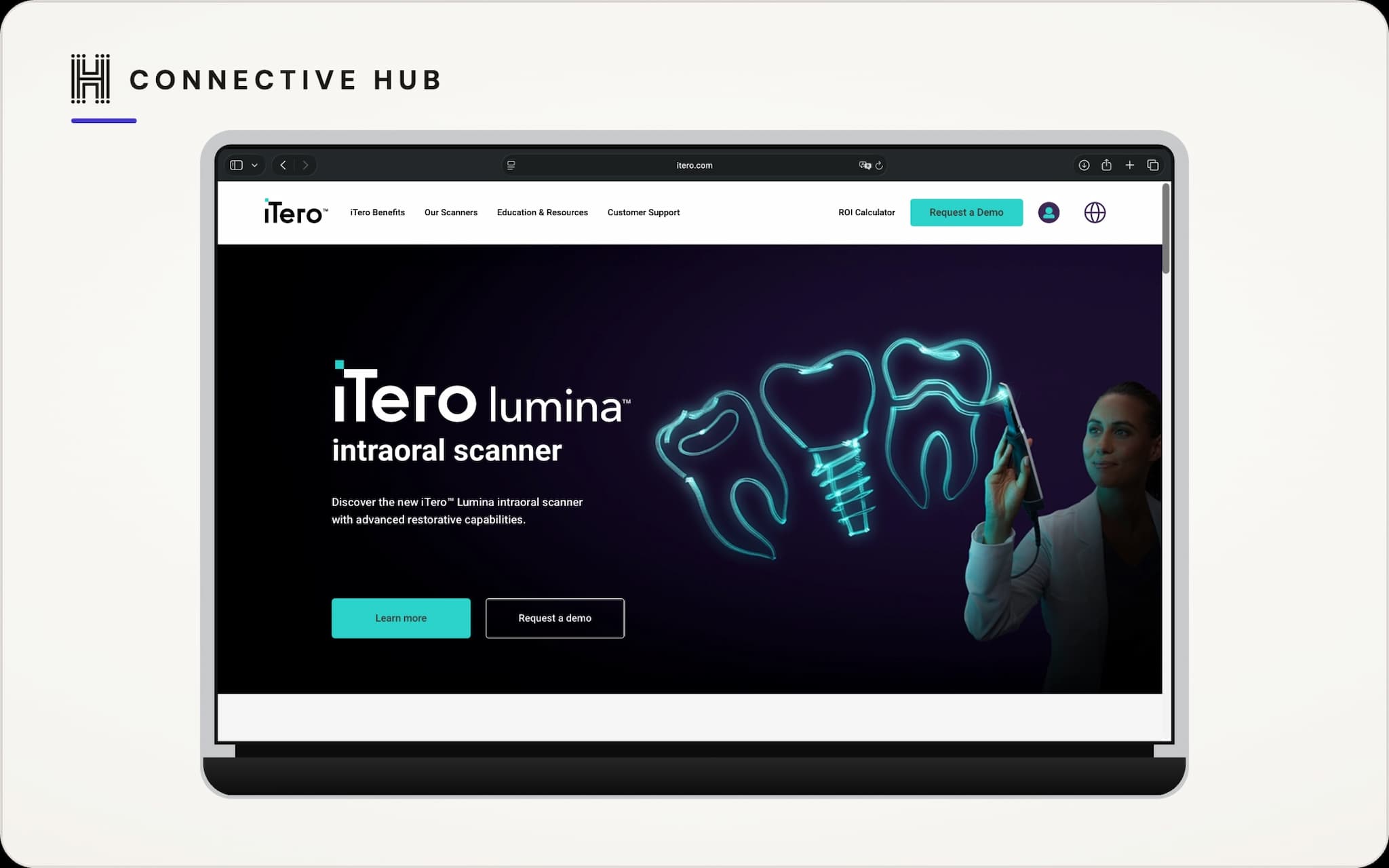 iTero — Product Site
