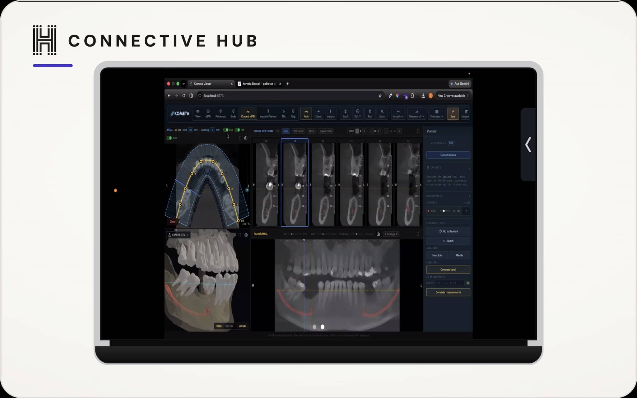 AI Analytics for Dentistry