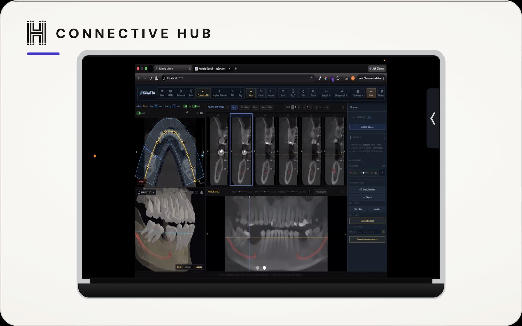 AI Analytics for Dentistry